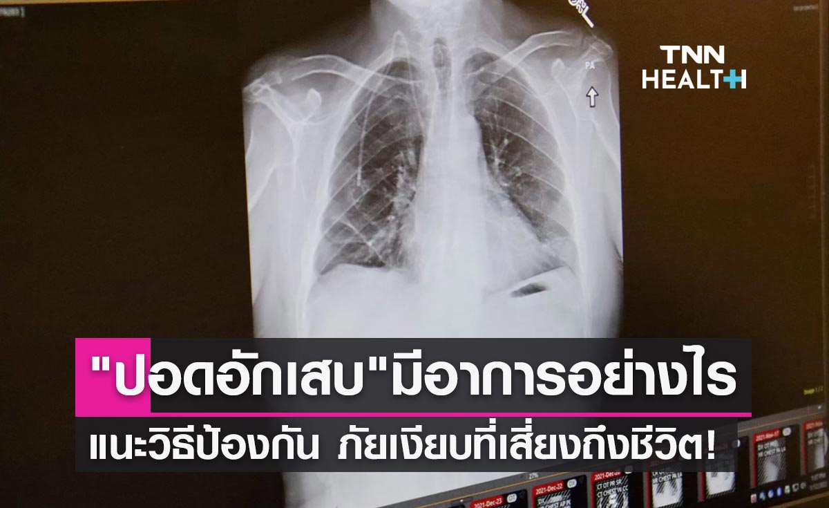 "โรคปอดอักเสบ" มีอาการอย่างไร-ติดต่อทางไหน ภัยเงียบที่เสี่ยงถึงชีวิต!