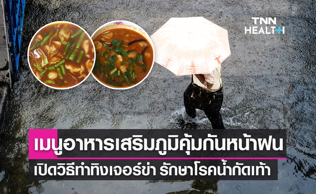ฝนตกบ่อย เปิดเมนูอาหารเสริมภูมิคุ้มกัน พร้อมแนะวิธีทำ "ทิงเจอร์ข่า" รักษาโรคน้ำกัดเท้า