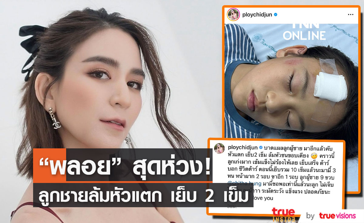 "พลอย ชิดจันทร์" สุดห่วงลูกชาย หัวแตก เย็บ 2 เข็ม