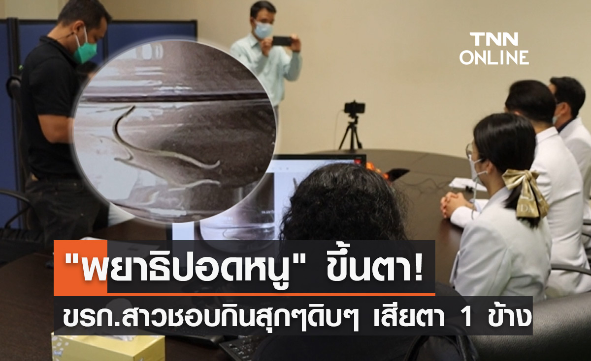 อุทาหรณ์กินดิบ! "พยาธิปอดหนู" ขึ้นตาทำข้าราชการสาวตาบอด 1 ข้าง