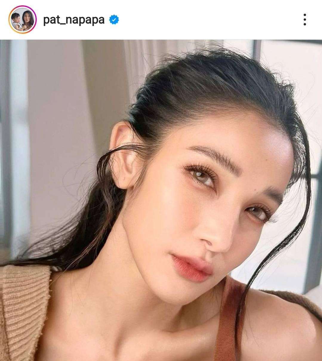 แพท ณปภา หายห่วง คุณแม่ อาการดีขึ้นแล้ว ลั่น ยังไหว แม้ค่าใช้จ่ายสูง แพท ณปภา หายห่วง คุณแม่ อาการดีขึ้นแล้ว ลั่น ยังไหว แม้ค่าใช้จ่ายสูง