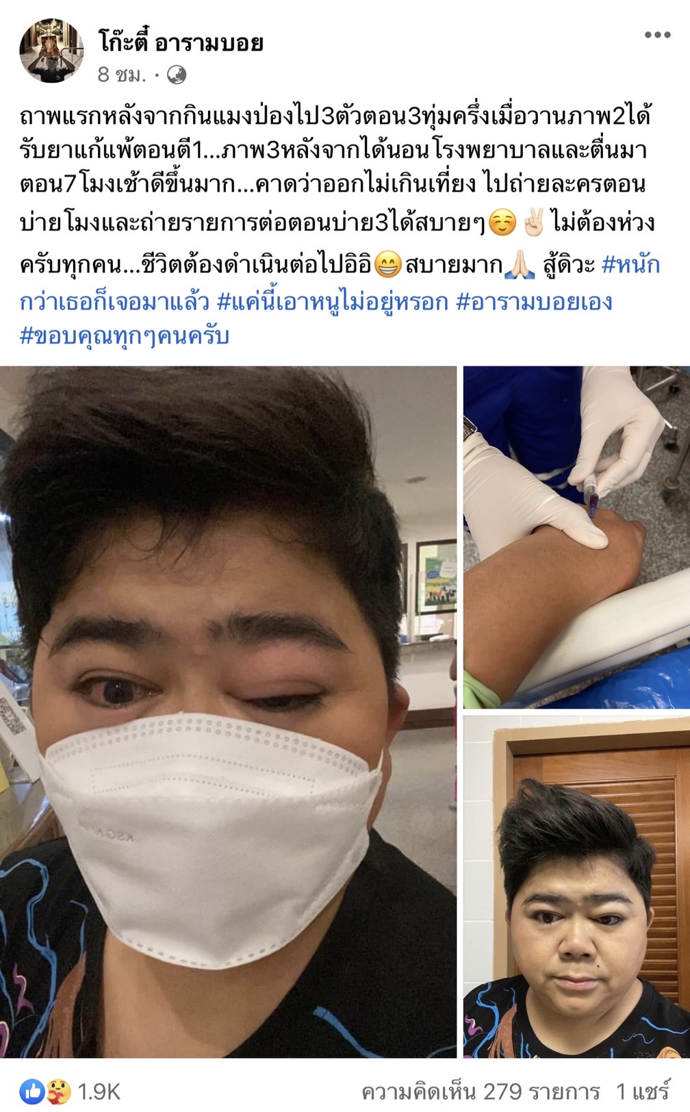 โก๊ะตี๋ แพ้หนัก!! หลังกินแมงป่อง 3 ตัว ต้องแอดมิทรพ.
