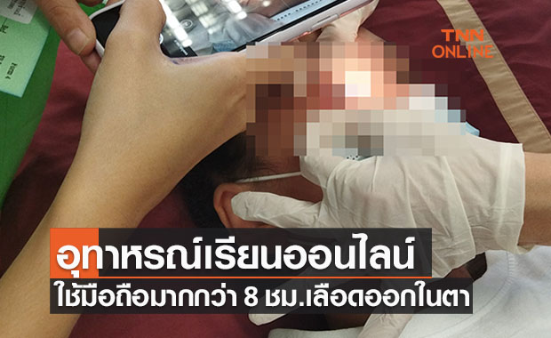 แม่โพสต์อุทาหรณ์! ลูกสาวเรียนออนไลน์-เล่นโทรศัพท์ เลือดออกในตา