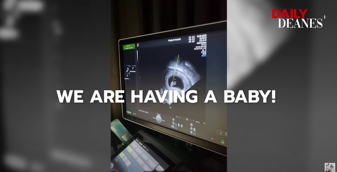  ลีเดีย เฉลยแล้ว! ภาพอัลตร้าซาวด์นั้นที่แท้เป็นลูกของน้องชาย 