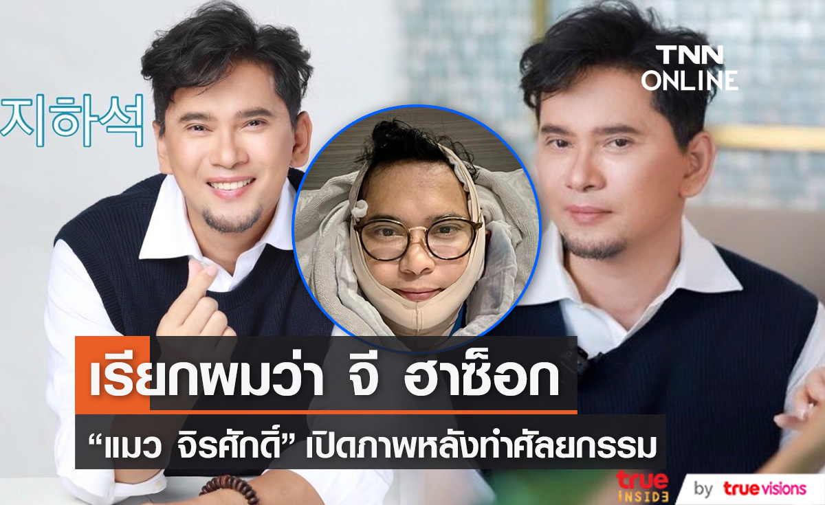 หล่อสมใจ! เปิดภาพ "แมว จิรศักดิ์" หลังทำศัลยกรรม 20 วัน ลั่นนี่น้าแมวไม่ใช่ณเดชน์นะ 