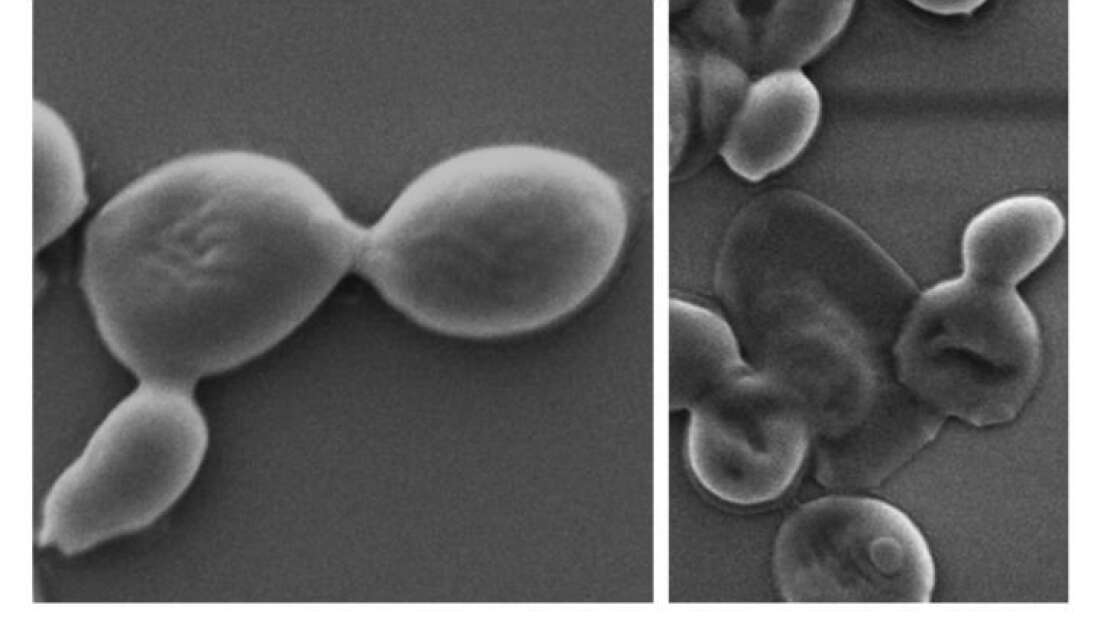แผ่นปิดแผลนาโนเทค ฆ่าเชื้อดื้อยาร้ายแรงได้ถึง 99% แผ่นปิดแผลนาโนเทค ฆ่าเชื้อดื้อยาร้ายแรงได้ถึง 99%
