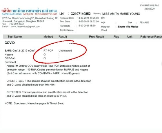 ทาทา และ น้องเร ผลตรวจโควิด-19 เป็นลบ
