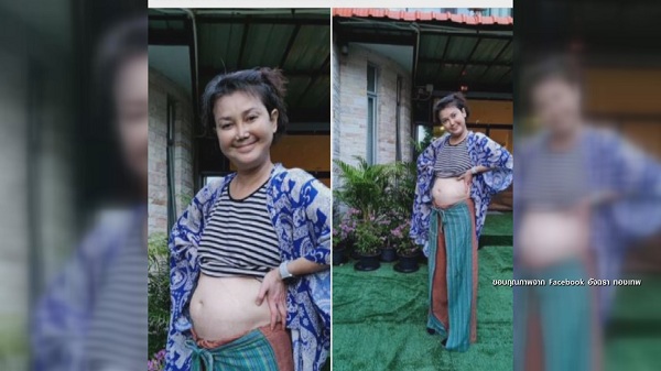 “เอ๋ อัจฉรา ทองเทพ เผยภาพใบหน้าและพุงที่บวม  (มีคลิป)