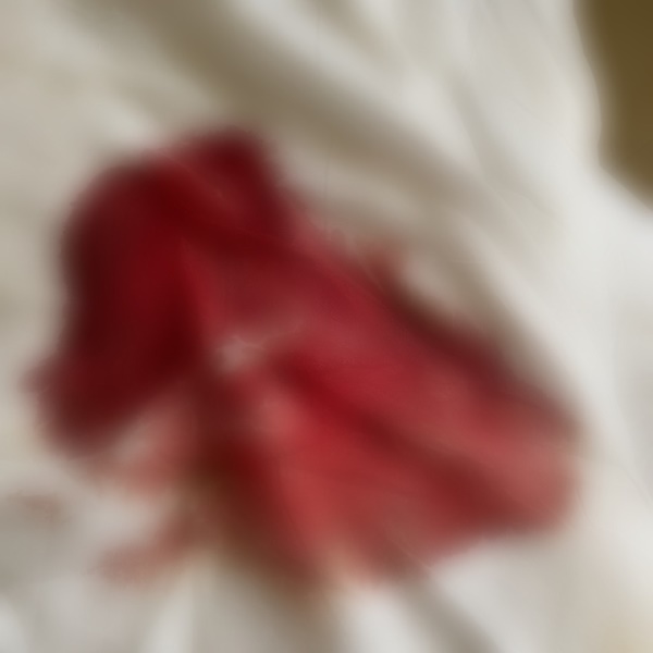 “อาร์ต KPN” โพสต์ภาพที่ทำแฟนคลับตกใจ!! เลือดกำดาวไหลเต็มที่นอน “อาร์ต KPN” โพสต์ภาพที่ทำแฟนคลับตกใจ!! เลือดกำดาวไหลเต็มที่นอน