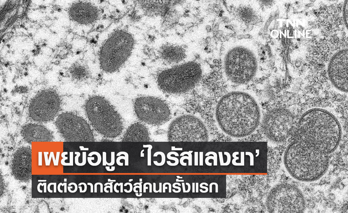 เผยข้อมูล ‘ไวรัสแลงยา’ ติดต่อจากสัตว์สู่คนครั้งแรก ติดเชื้อแล้ว 35 ราย 