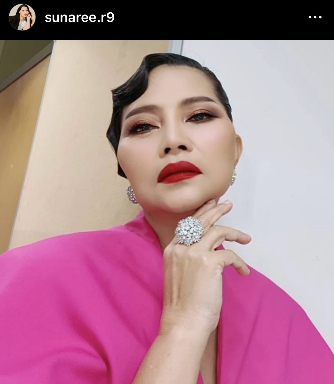 สุนารี ไม่กังวล แต่อดไม่ได้ เป็นห่วงสามี เข้ารับการผ่าตัด