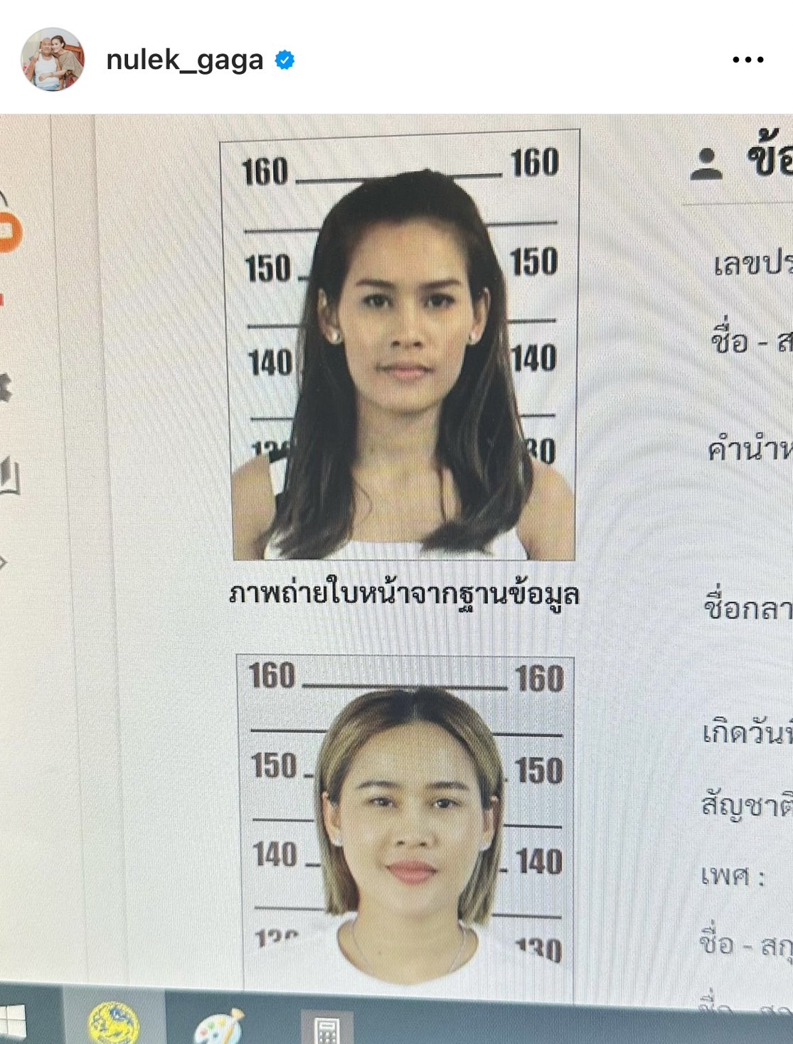 หนูเล็ก ก่อนบ่าย เปิดภาพติดบัตร อดีต-ปัจจุบัน ยันไม่ได้ศัลยกรรม 