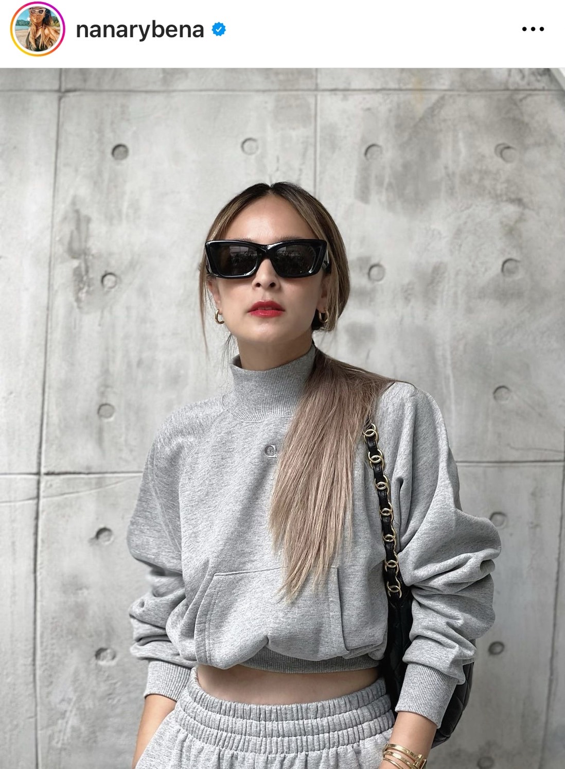 นานา ไรบีน่า เผยอาการ เวย์ ไทยเทเนี่ยม หมอสั่งพักยาว 6-8 สัปดาห์ 