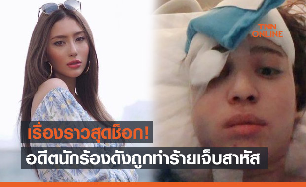 เรื่องราวสุดช็อก! 'มีล่า' อดีตนักร้องดัง เมื่อ2ปีก่อนถูกทำร้ายจนบาดเจ็บสาหัส