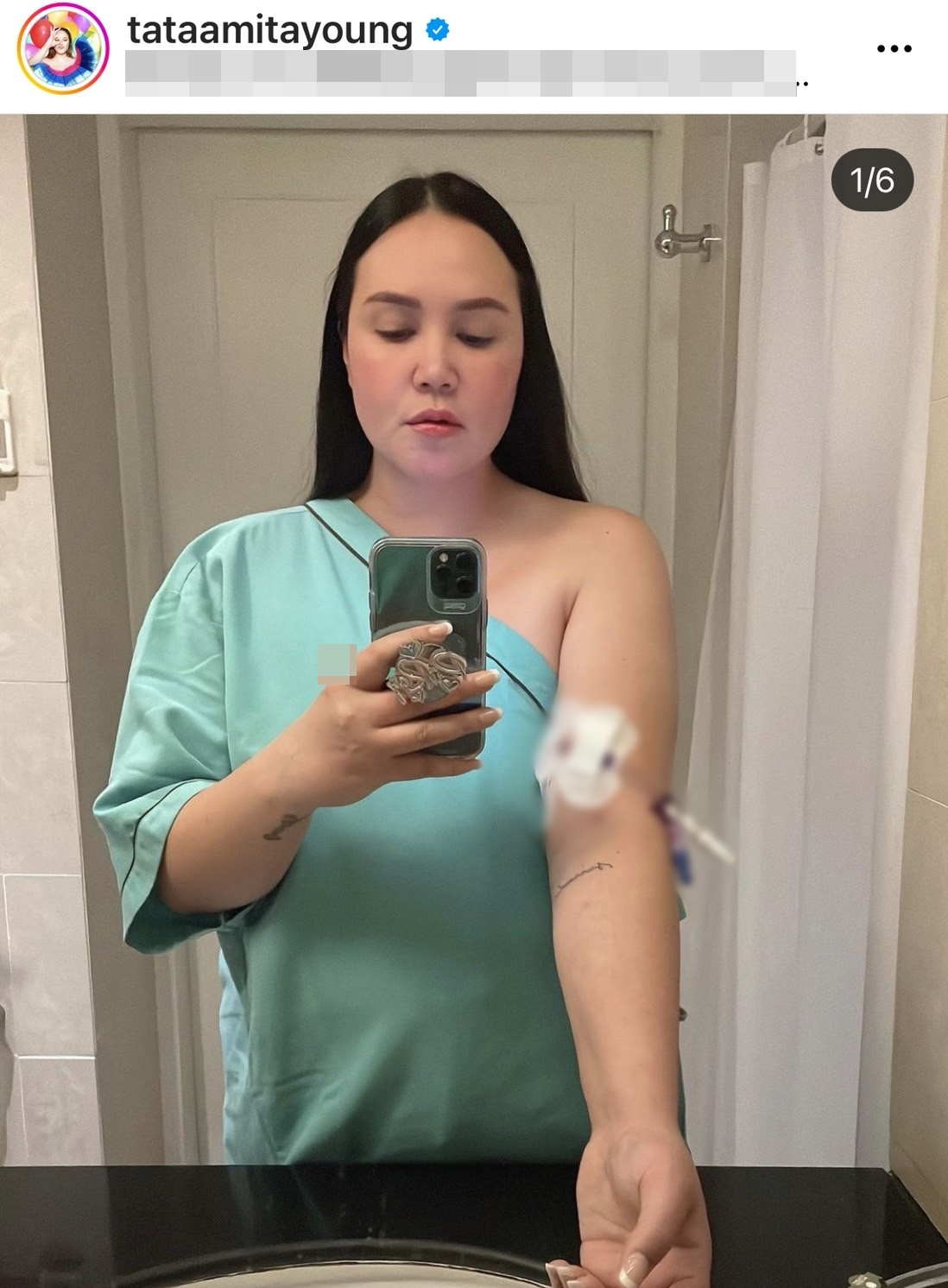 ทาทา ยัง แชร์ประสบการณ์เข้าห้องผ่าตัด ขณะติดโควิด-19 ด้วยสาเหตุนี้!! ทาทา ยัง แชร์ประสบการณ์เข้าห้องผ่าตัด ขณะติดโควิด-19 ด้วยสาเหตุนี้!!