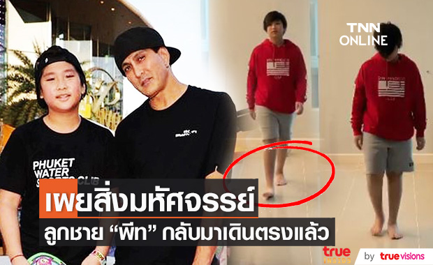 มหัศจรรย์!! ลูกชาย "พีท ทองเจือ" กลับมาเดินตรงแล้ว 