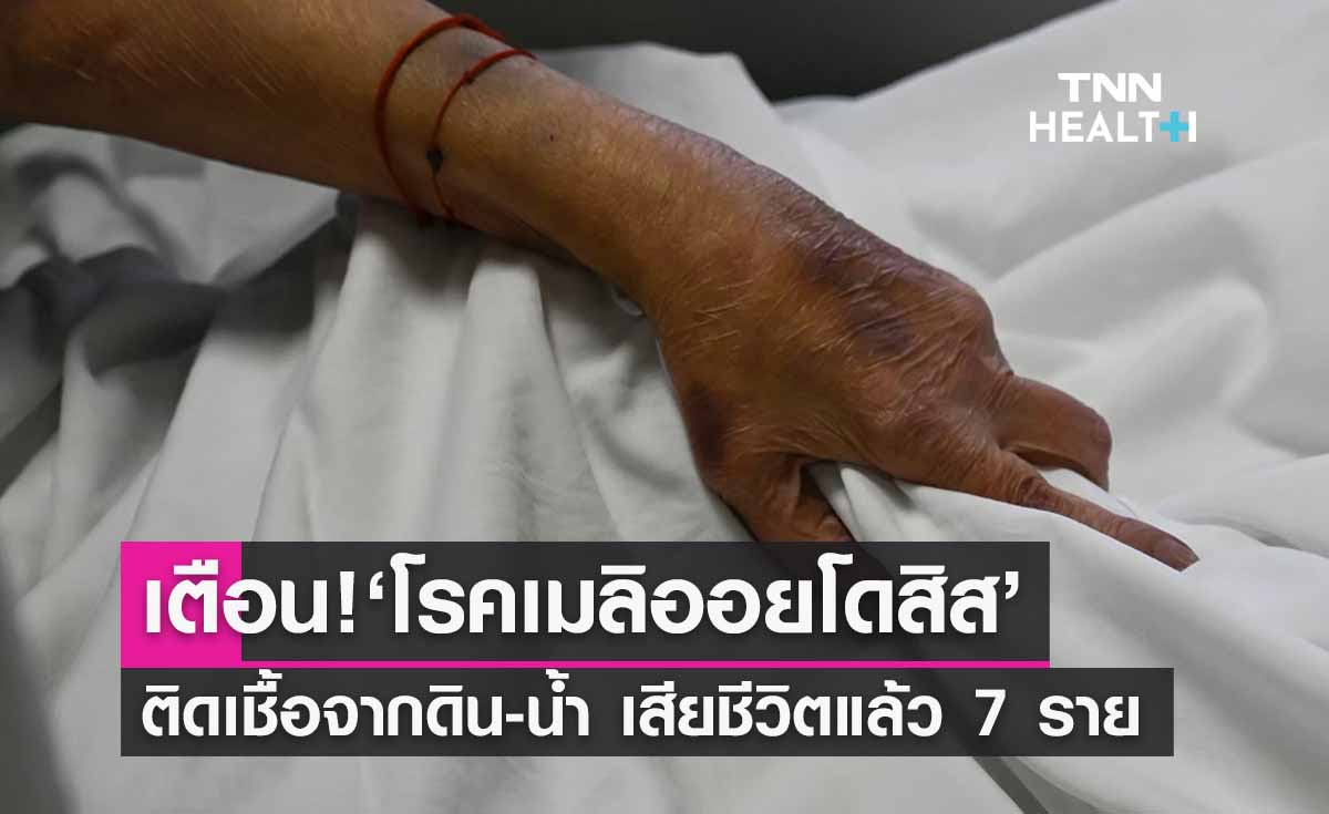 เตือน! ระวัง ‘โรคเมลิออยโดสิส’ ติดเชื้อจากดิน-น้ำ คร่าชีวิตคนไทยแล้ว 7 ราย 