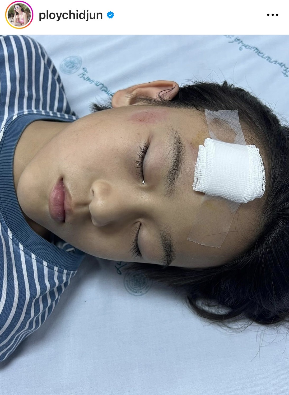 พลอย ชิดจันทร์ สุดห่วงลูกชาย หัวแตก เย็บ2 เข็ม