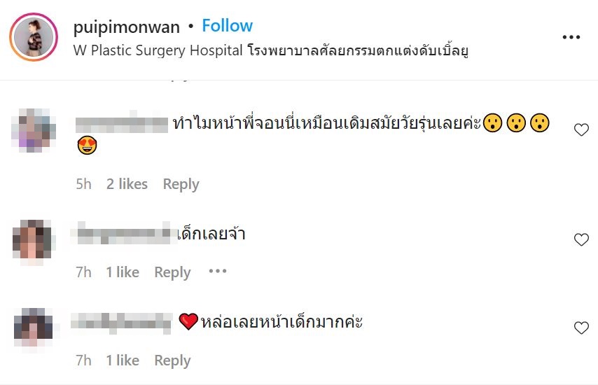 จอนนี่ แอนโฟเน่ ทำศัลยกรรม แฟนคลับแห่ชม หน้าเด็กเหมือนเมื่อ 30 ปีก่อน