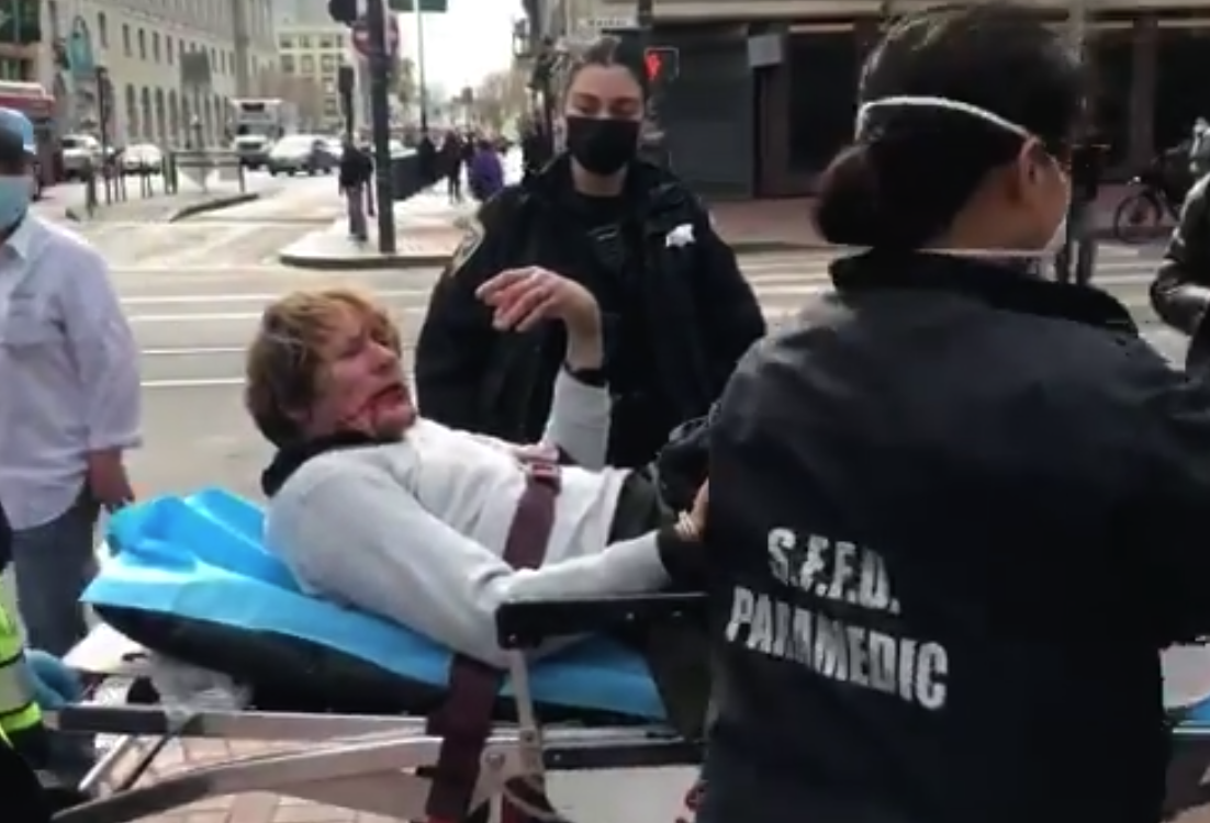 ชายผิวขายต่อยอาม่ากลางเมืองซานฟรานฯ เจอสู้กลับไม้ฟาดไม่ยั้งจนเจ็บหนักเอง ชายผิวขายต่อยอาม่ากลางเมืองซานฟรานฯ เจอสู้กลับไม้ฟาดไม่ยั้งจนเจ็บหนักเอง