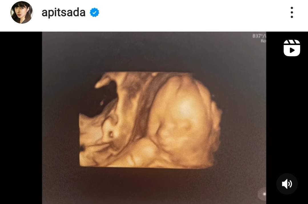 ไอซ์ อภิษฎา เผยโฉมหน้าลูกสาวครั้งแรก ตื้นเต้นใกล้คลอดแล้ว ไอซ์ อภิษฎา เผยโฉมหน้าลูกสาวครั้งแรก ตื้นเต้นใกล้คลอดแล้ว