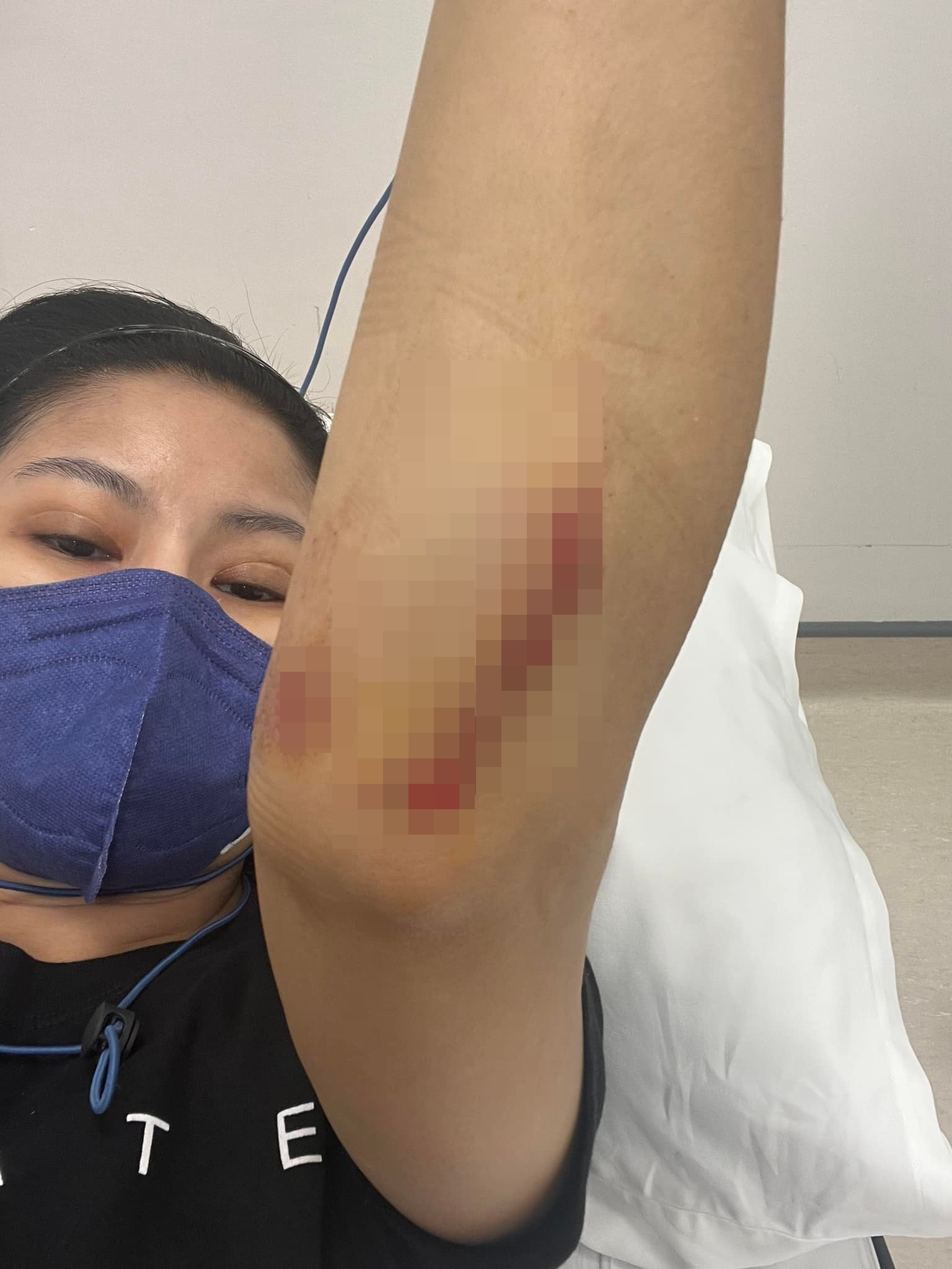 อดีตนักร้องดัง โรสแมรี่ ถูกรถชนแล้วหนี พร้อมเผยอาการบาดเจ็บ อดีตนักร้องดัง โรสแมรี่ ถูกรถชนแล้วหนี พร้อมเผยอาการบาดเจ็บ