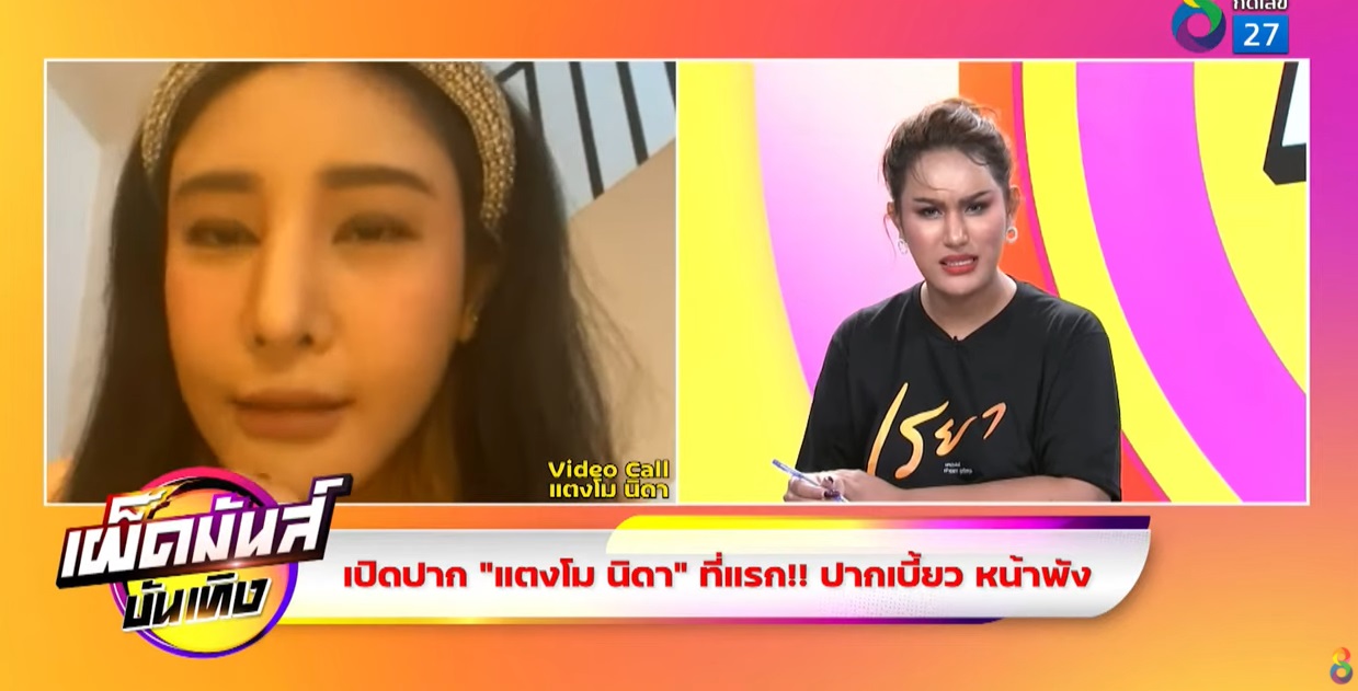แตงโม นิดา เปิดใจครั้งแรก ปมศัลยกรรมทำพิษ