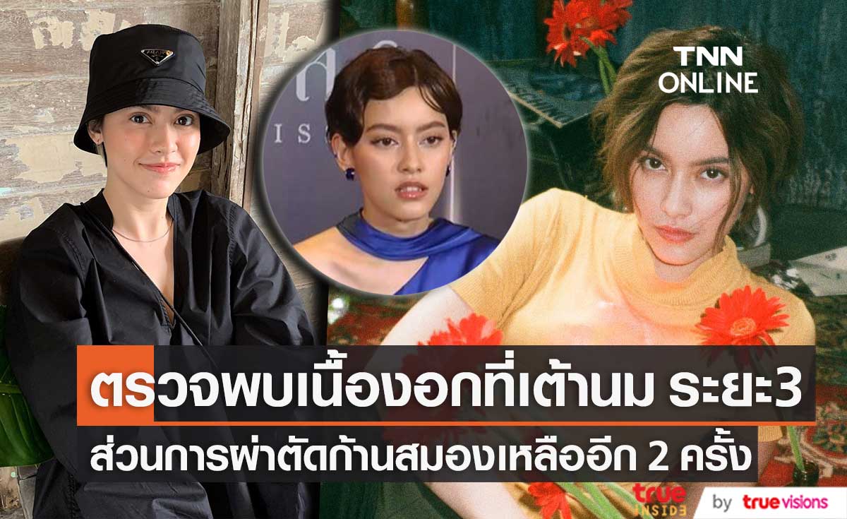 "นิ้ง ชัญญา" เผย ไม่เครียด หลังตรวจพบเนื้องอกที่เต้านม ระยะ 3 ส่วนการผ่าตัดก้านสมอง เหลืออีก 2 ครั้ง