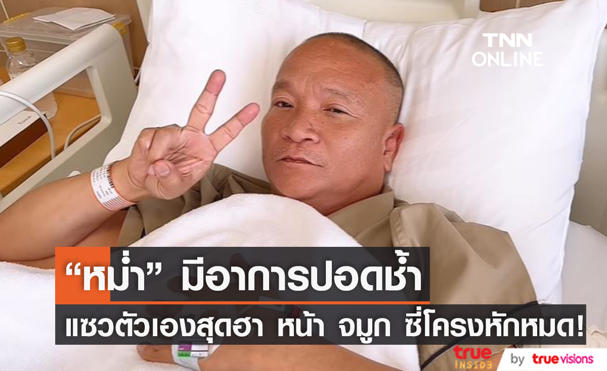 "หม่ำ จ๊กมก" พบอาการปอดช้ำ ใกล้ได้กลับบ้าน แถมแซวตัวเอง หน้า จมูก ซี่โครงก็หัก!! (มีคลิป)