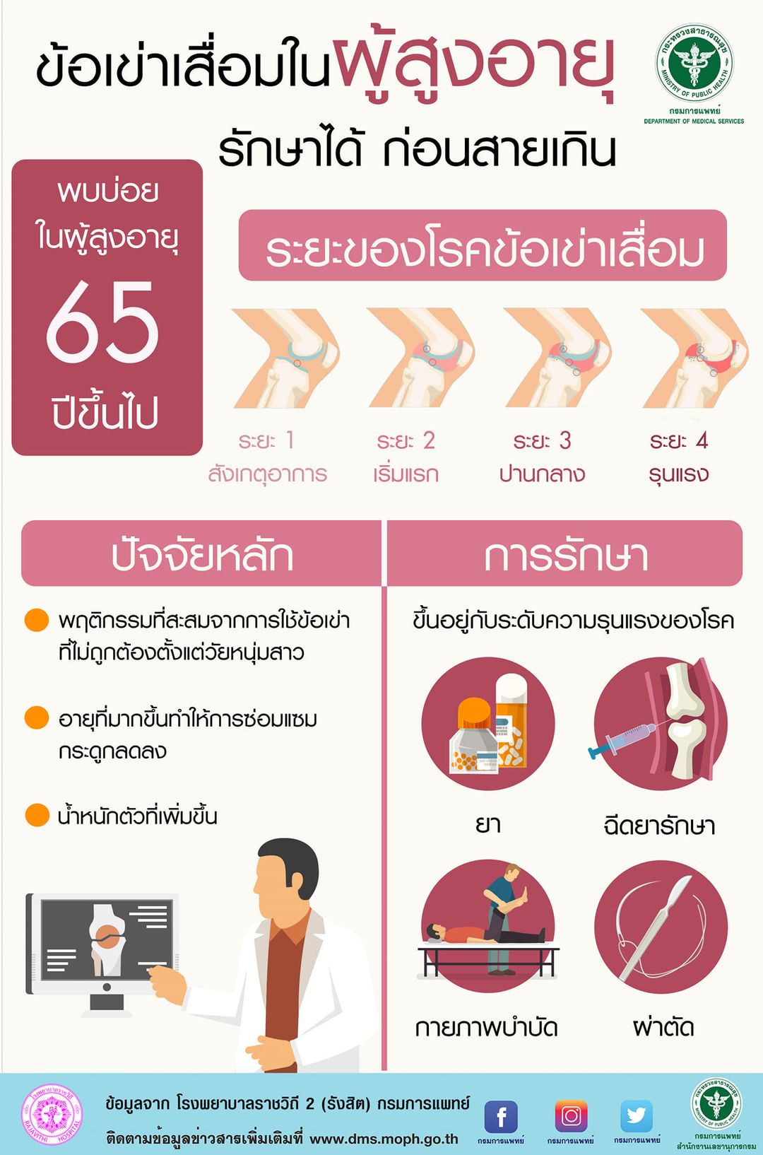 “ข้อเข่าเสื่อม” เปิดอาการป่วยระยะแรก รีบพบหมอก่อนสายเกินแก้ “ข้อเข่าเสื่อม” เปิดอาการป่วยระยะแรก รีบพบหมอก่อนสายเกินแก้