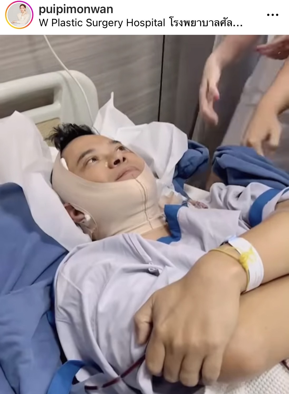 แมว จิรศักดิ์ ตอบสุดฮา หลังทำศัลยกรรมครั้งแรก บอกตัวเองชื่อ ณเดชน์