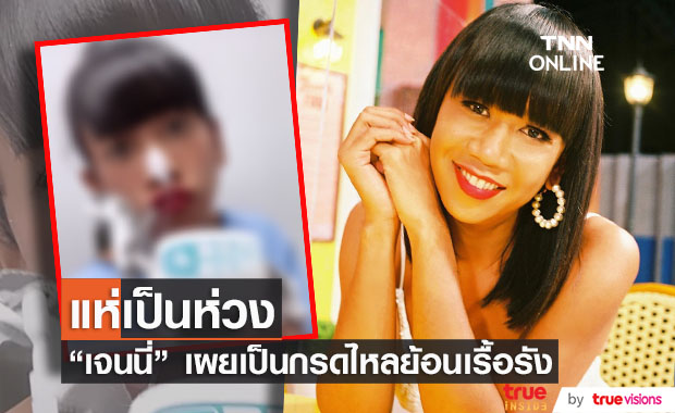 "เจนนี่ ปาหนัน" เผยภาพสอดท่อ รักษาโรคกรดไหลย้อนที่เป็นมานานนับปี!!
