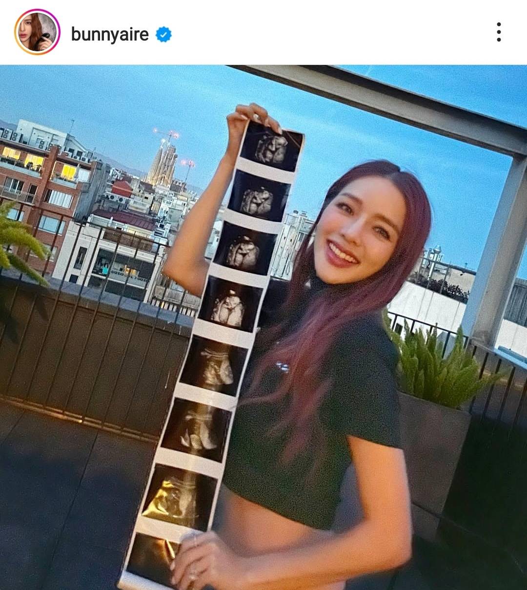 “แอร์ ภัณฑิลา” อัปเดตชีวิตว่าที่คุณแม่ป้ายแดง เผยได้ฤกษ์คลอดเดือนสิงหาคมนี้ “แอร์ ภัณฑิลา” อัปเดตชีวิตว่าที่คุณแม่ป้ายแดง เผยได้ฤกษ์คลอดเดือนสิงหาคมนี้