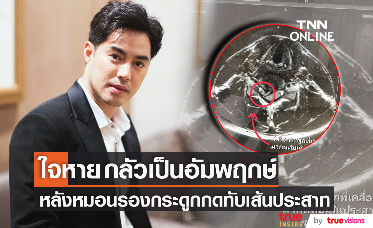 "ท็อป จรณ" กลัวเป็นอัมพฤกษ์ หลังหมอนรองกระดูกกดทับเส้นประสาทรุนแรง