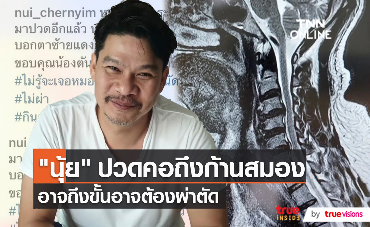 "นุ้ย เชิญยิ้ม" อยู่ในช่วงตัดสินใจ จะผ่าตัด หมอนรองกระดูกคออักเสบ หรือไม่   (มีคลิป)
