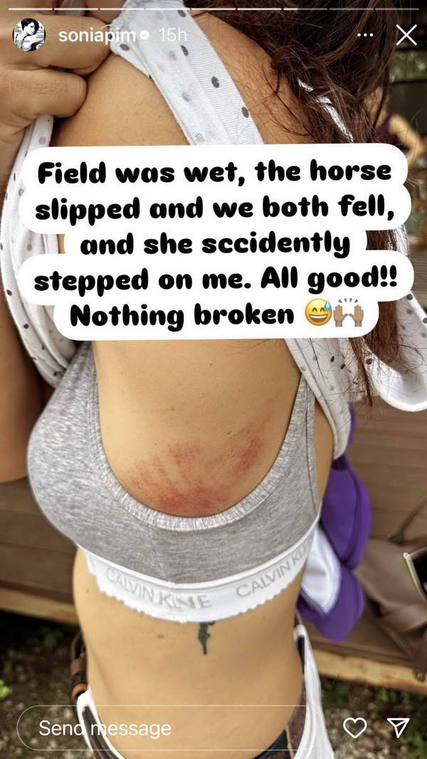 แทบช็อก! พิม ซอนย่า พลาดตกม้า แถมโดนเหยียบซ้ำ ระหว่างแข่งขันโปโล แทบช็อก! พิม ซอนย่า พลาดตกม้า แถมโดนเหยียบซ้ำ ระหว่างแข่งขันโปโล