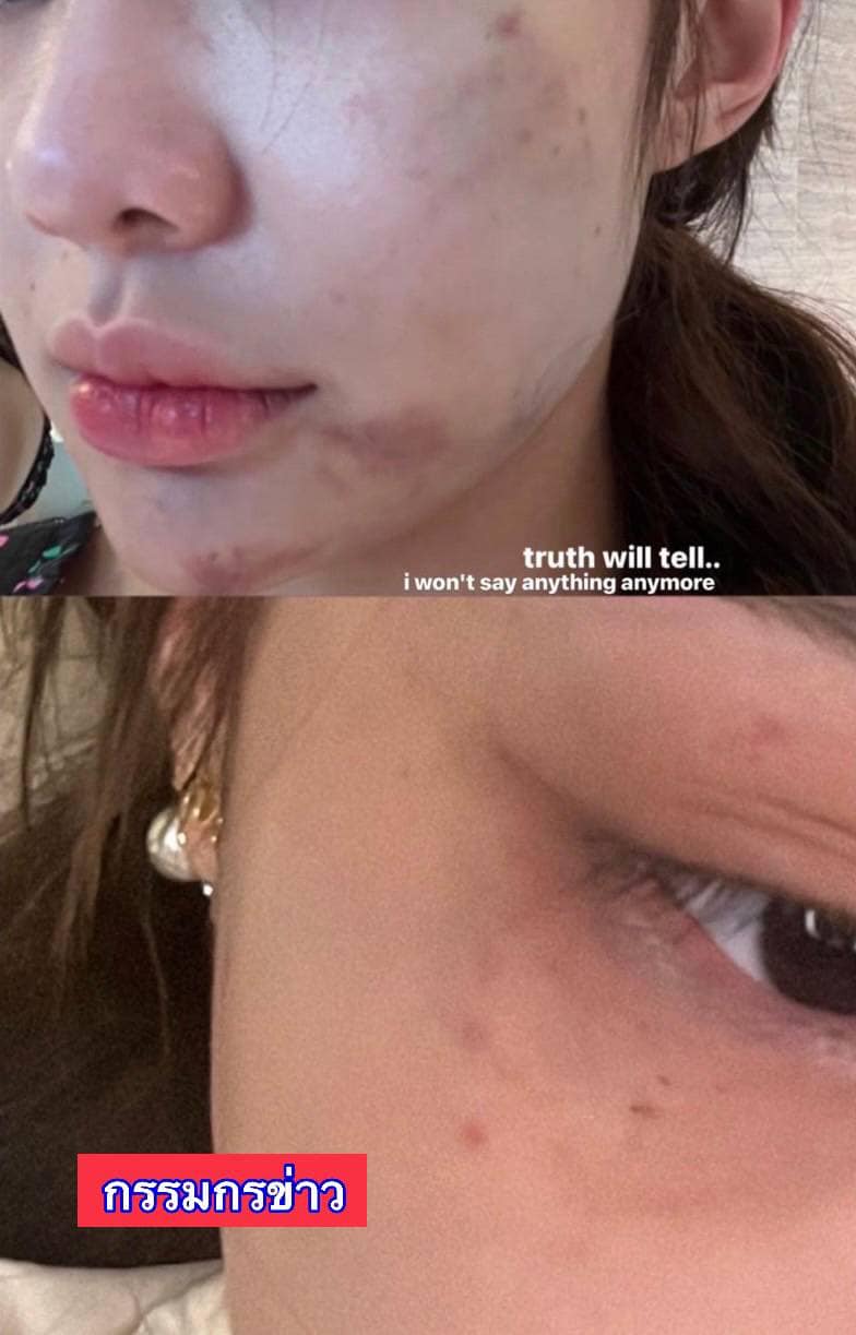 คนใกล้ชิด จีจี้ สุพิชชา เผยเคยถูกฝ่ายชายเอาปืนจ่อหัว สรยุทธ เปิดภาพถูกทำร้ายร่างกาย