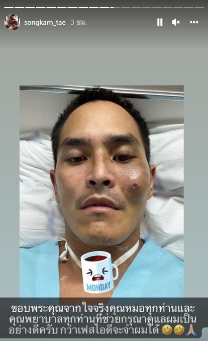 สงกรานต์ กลับบ้านได้เเล้ว หลังประสบอุบัติเหตุบาดเจ็บสาหัส เข้า ICU