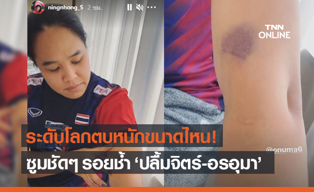 เปิดภาพรอยช้ำ "ปลื้มจิตร์-อรอุมา" ในการแข่งวอลเลย์บอล ศึกเนชั่นส์ลีก