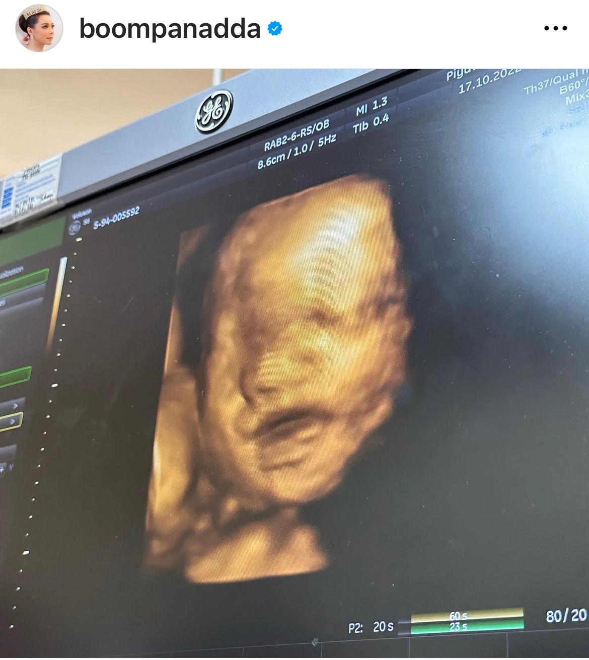 เปิดภาพแรกลูกชาย บุ๋ม ปนัดดา พร้อมหน้าคุณพ่อ ก็อต อธิป เปิดภาพแรกลูกชาย บุ๋ม ปนัดดา พร้อมหน้าคุณพ่อ ก็อต อธิป