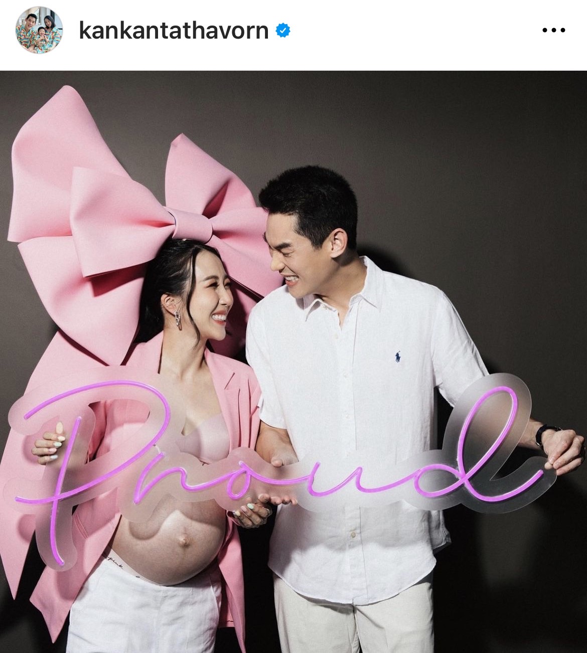 กันต์ กันตถาวร เฮลั่น! ภรรยาคลอดลูกสาว น้องพราว กันต์ กันตถาวร เฮลั่น! ภรรยาคลอดลูกสาว น้องพราว