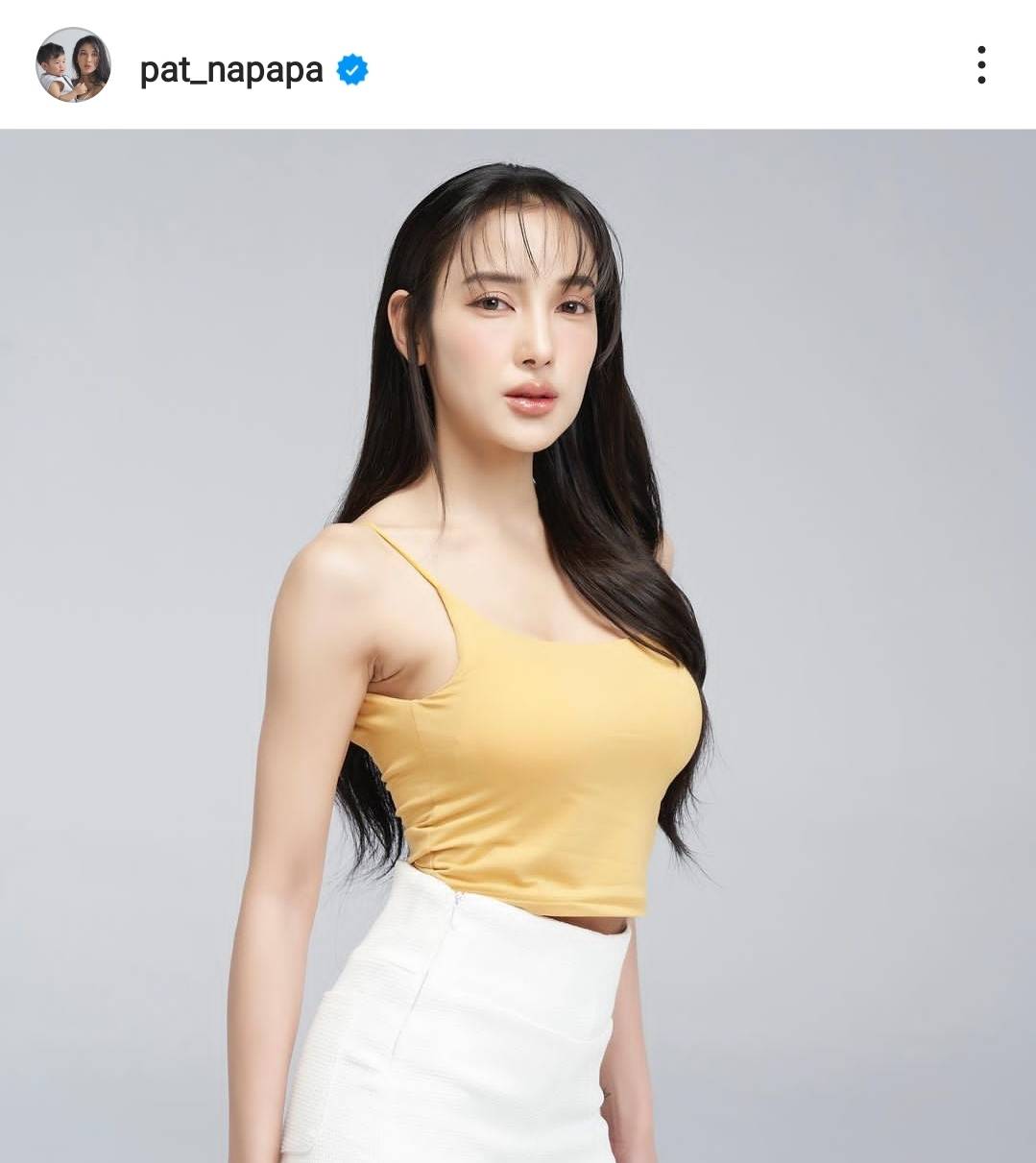 หลงรักรุ่นพี่ นุ๊ก ธนดล เผยภาพเจอ แพท ณปภา ครั้งแรกเมื่อ 10 ปีก่อน หลงรักรุ่นพี่ นุ๊ก ธนดล เผยภาพเจอ แพท ณปภา ครั้งแรกเมื่อ 10 ปีก่อน