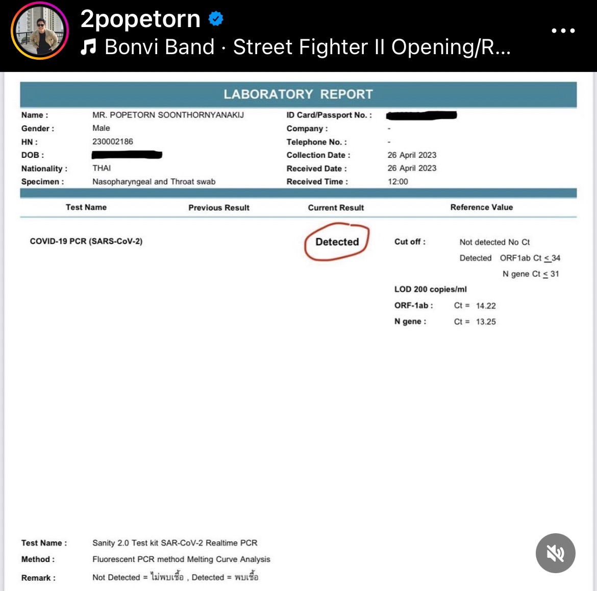 ตู่ ภพธร ติดโควิดรอบ 2 ขอโทษยกเลิกงานกะทันหัน ตู่ ภพธร ติดโควิดรอบ 2 ขอโทษยกเลิกงานกะทันหัน