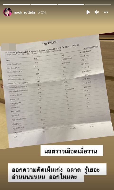 นุ๊ก เปิดใจ หลังชาวเน็ตหาว่าแกล้งหน้าเบี้ยว เผย ไม่ได้โกรธ แต่คอมเมนต์อะไรให้ระวัง นุ๊ก เปิดใจ หลังชาวเน็ตหาว่าแกล้งหน้าเบี้ยว เผย ไม่ได้โกรธ แต่คอมเมนต์อะไรให้ระวัง