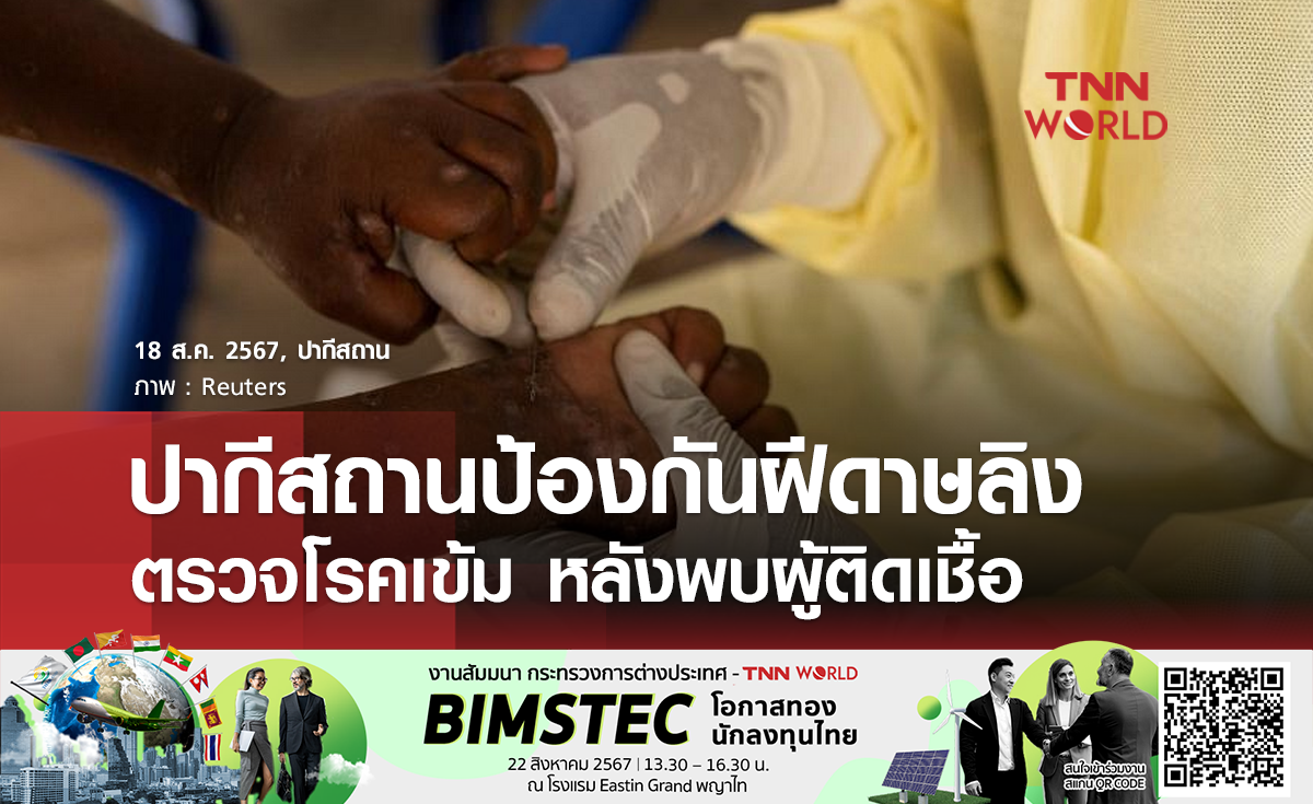 ปากีสถานตรวจโรคเข้ม หลังพบผู้ติดเชื้อฝีดาษลิงคนแรก