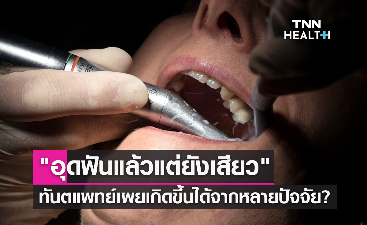 "อุดฟันแล้วแต่ยังเสียว" ทันตแพทย์เผยเกิดขึ้นได้จากหลายปัจจัย?