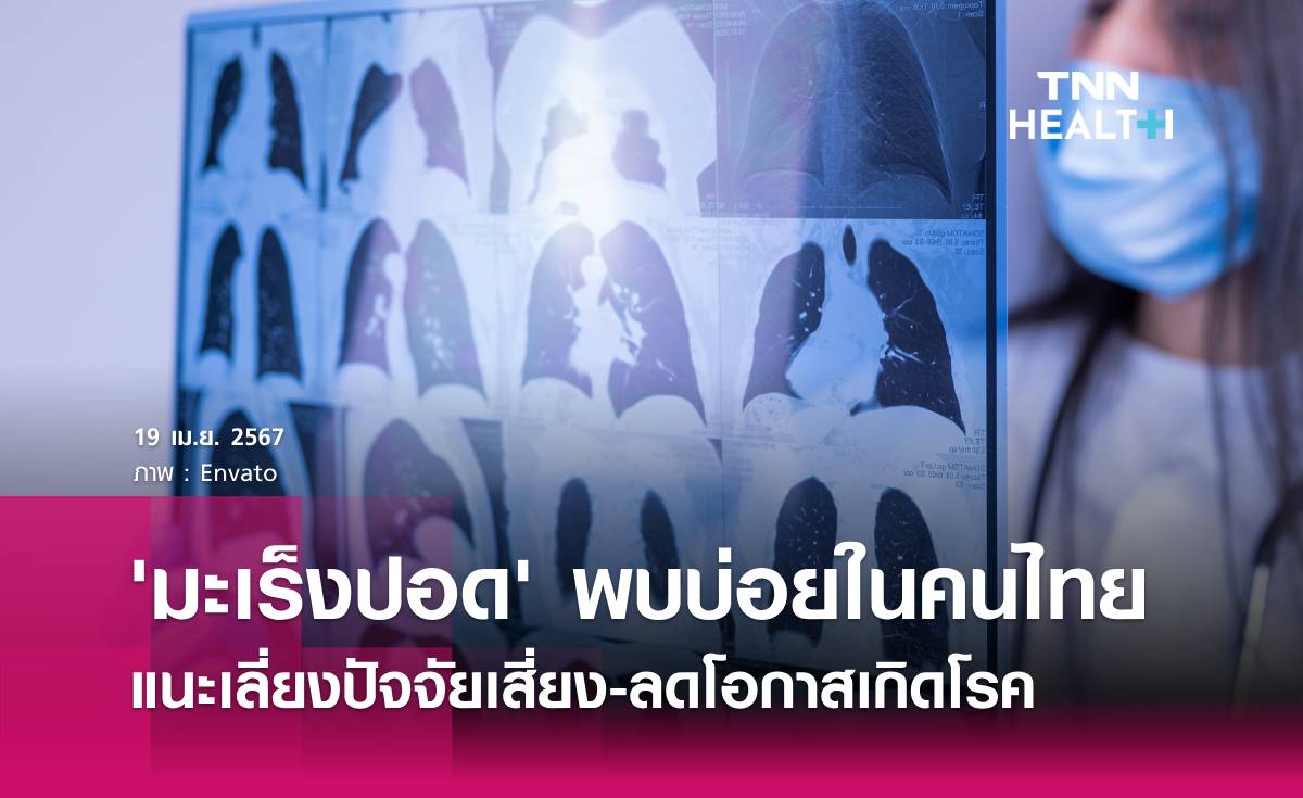 สถาบันมะเร็งแห่งชาติแนะเลี่ยงปัจจัยเสี่ยงมะเร็งปอด