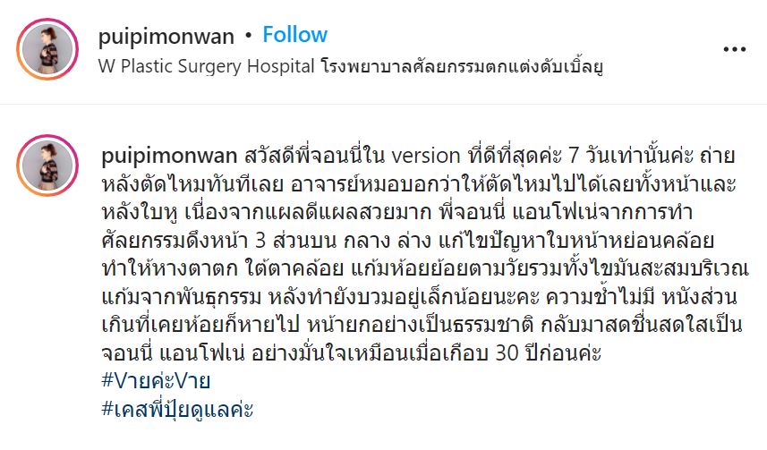 เด็กลงมาก จอนนี่ แอนโฟเน่