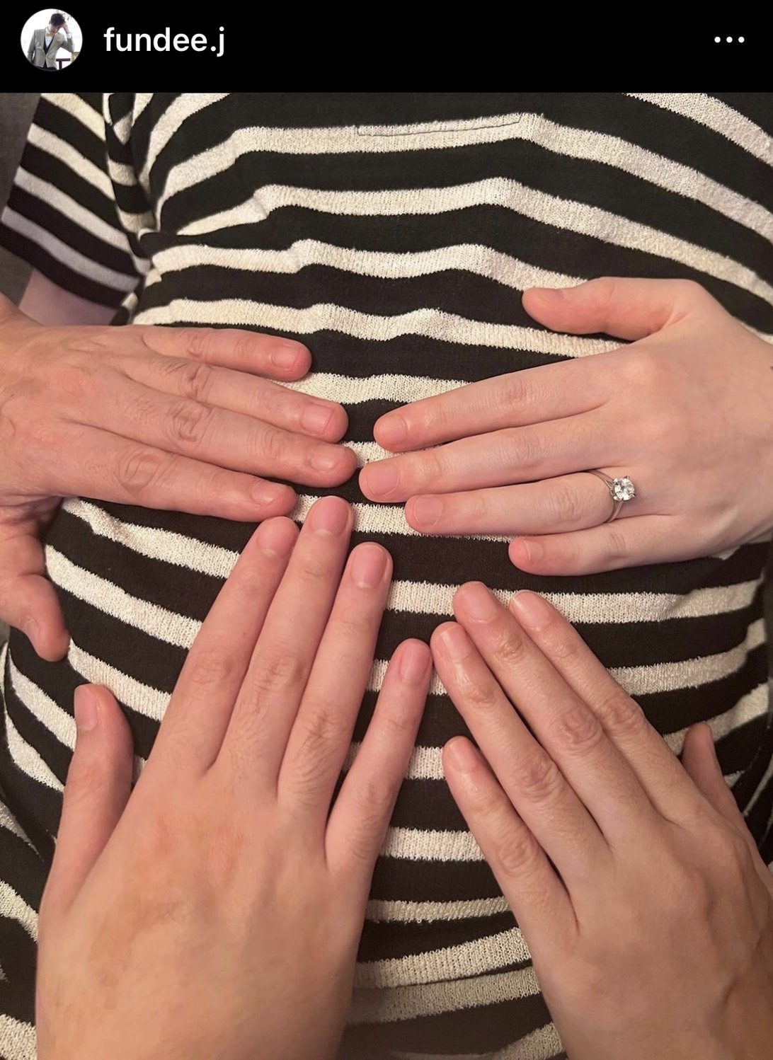 คุณตาฝันดี ดีใจมาก!  จินนี่ ลูกสาวตั้งท้องทายาทคนแรก