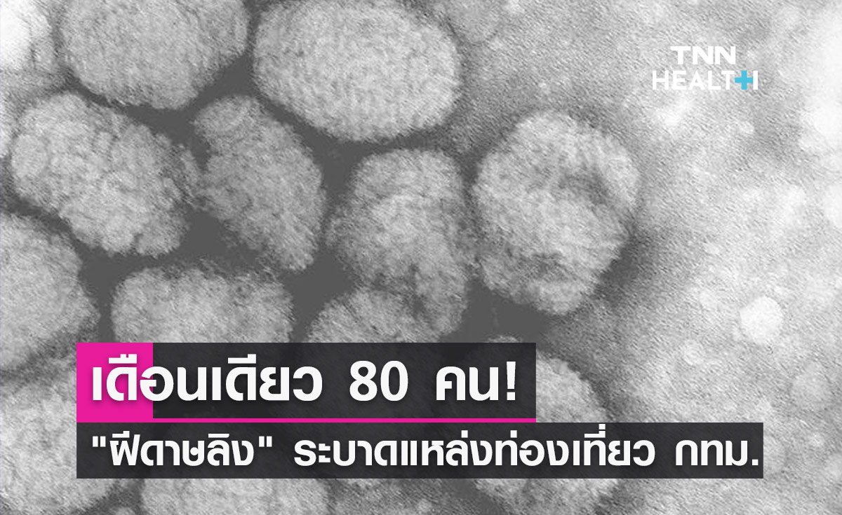 ฝีดาษลิง ระบาดแหล่งท่องเที่ยวกทม.! สิงหาคมพบผู้ป่วย 80 ราย อายุน้อยสุด 18 ปี